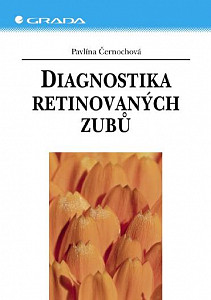 E-kniha Diagnostika retinovaných zubů