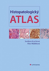 E-kniha Histopatologický atlas