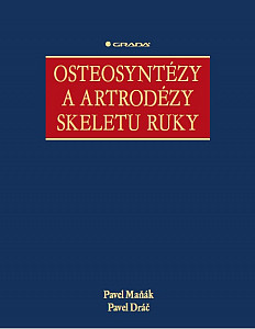 E-kniha Osteosyntézy a artrodézy skeletu ruky