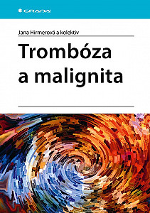 E-kniha Trombóza a malignita