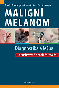 Maligní melanom - Diagnostika a léčba