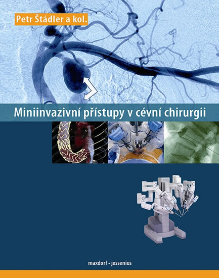 Miniinvazivní přístupy v cévní chirurgií