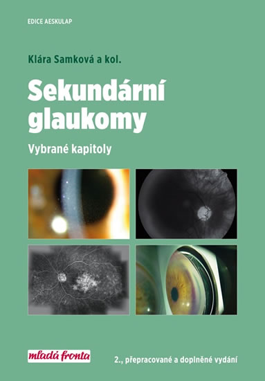 Sekundární glaukomy