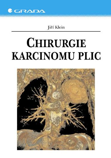 E-kniha Chirurgie karcinomu plic