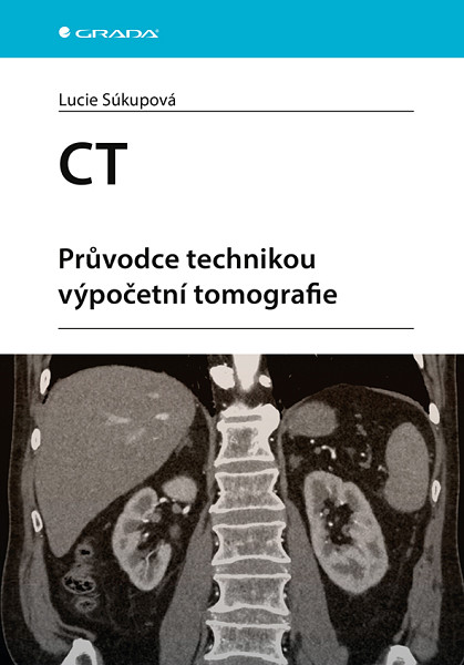 E-kniha CT - Průvodce technikou výpočetní tomografie