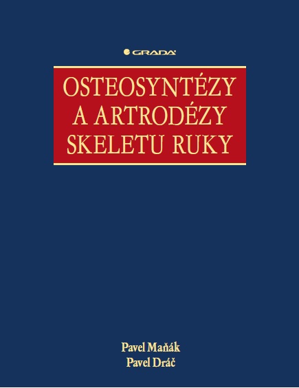 E-kniha Osteosyntézy a artrodézy skeletu ruky