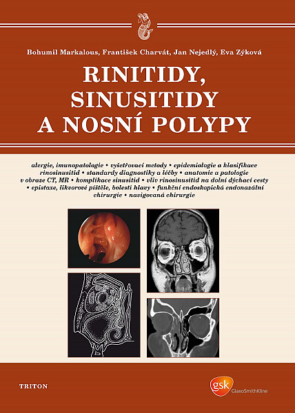 E-kniha Rinitidy, sinusitidy a nosní polypy