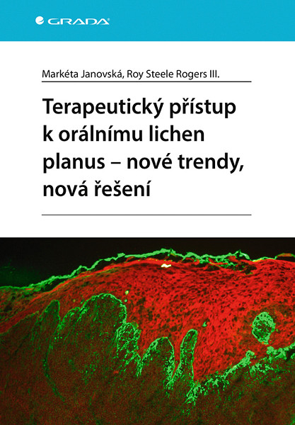 E-kniha Terapeutický přístup k orálnímu lichen planus - nové trendy, nová řešení