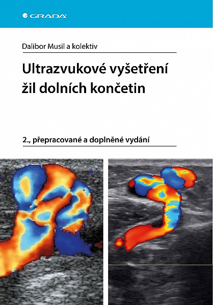 E-kniha Ultrazvukové vyšetření žil dolních končaetin