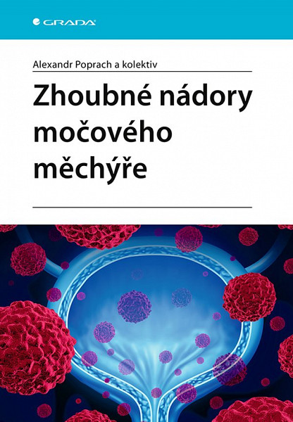 E-kniha Zhoubné nádory močového měchýře